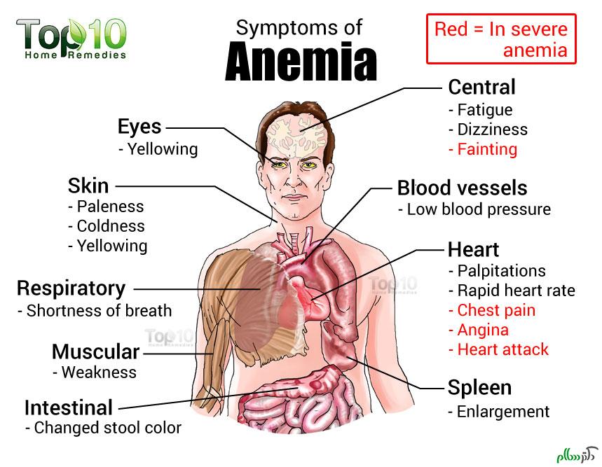 anemia-symptoms