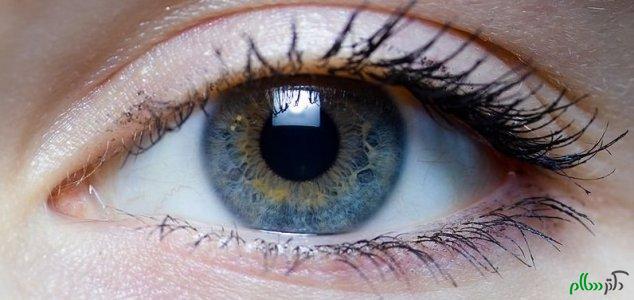 ریسک ابتلا به سرطان چشم و ژنتیک