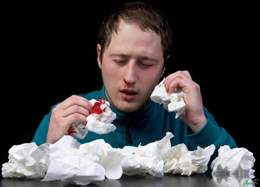 man-with-bloody-nose-near-tissues