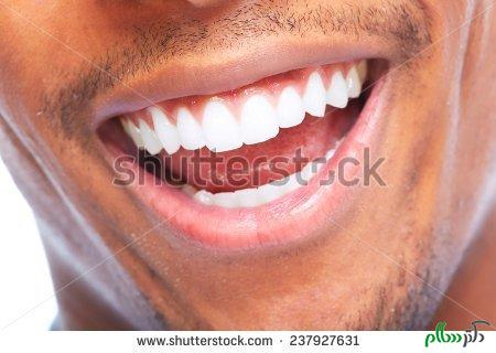 stock-photo-african-american-man-smile-dental-health-care-237927631