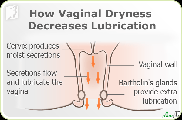 vaginal-dryness-secretions