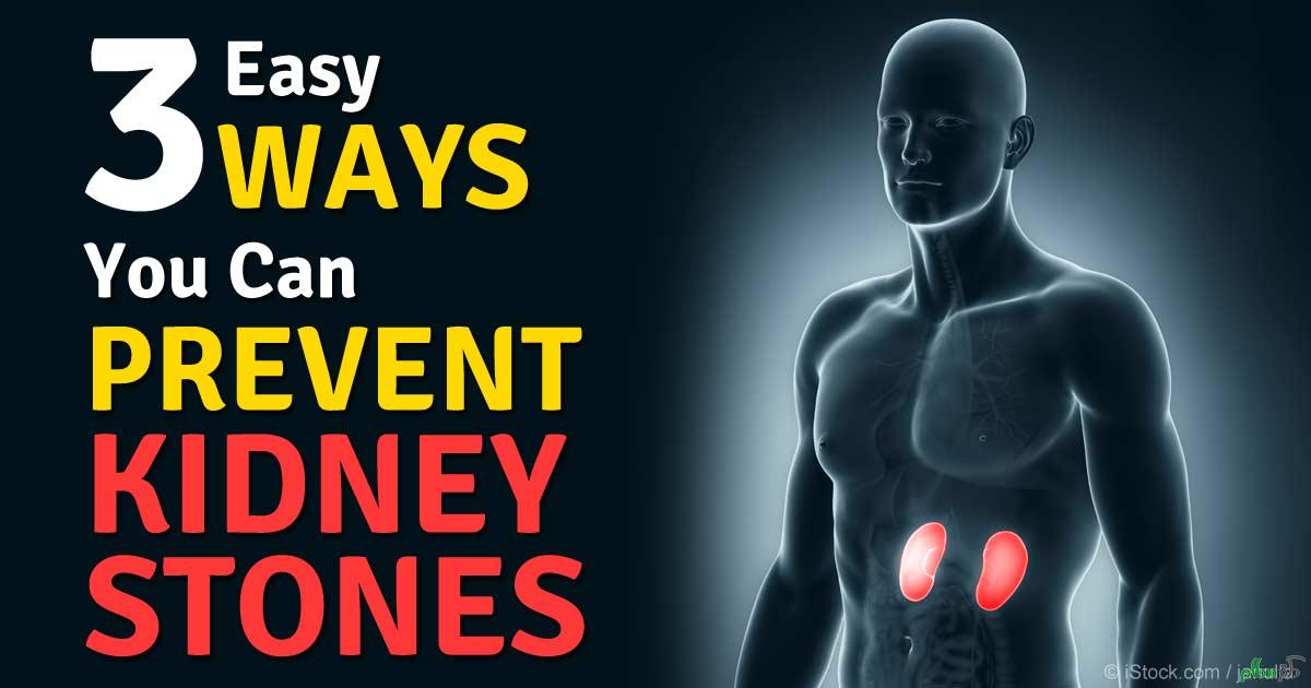 3-ways-prevent-kidney-stones-fb