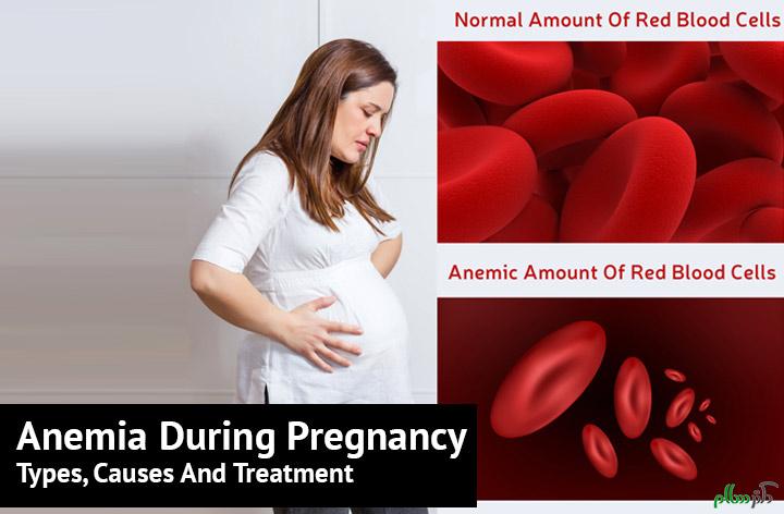 anemia-during-pregnancy