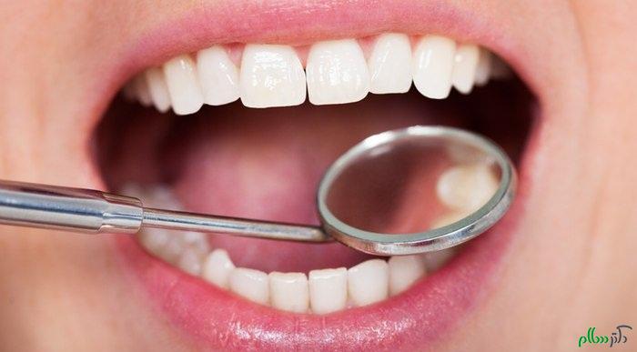 میلیون ها دندان در دهان