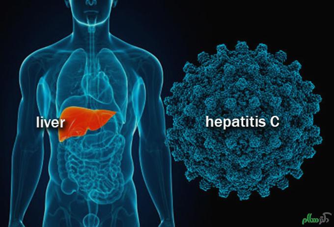 hepatitis-c