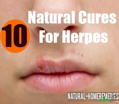 herpes-cures