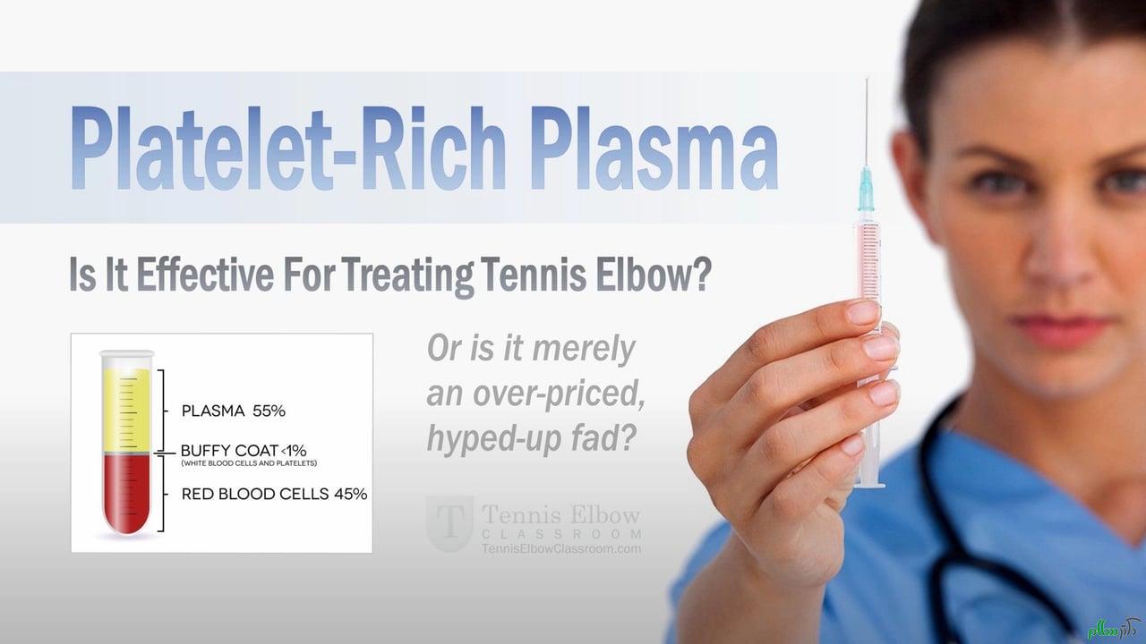 platelet-rich-plasma-for-tennis-elbow-does-it-work