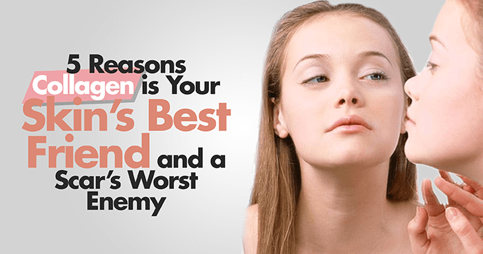 5-reasons-collagen-is-your-skins-best-friend-and-a-scars-worst-enemy
