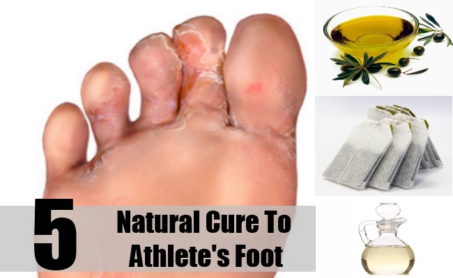 natural-cure-to-athletes-foot1