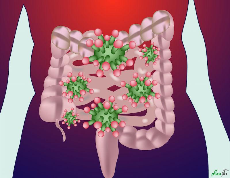 gut-bacteria-diagram-151021