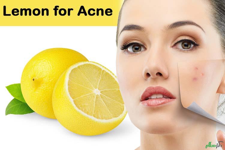 lemon-for-acne-method