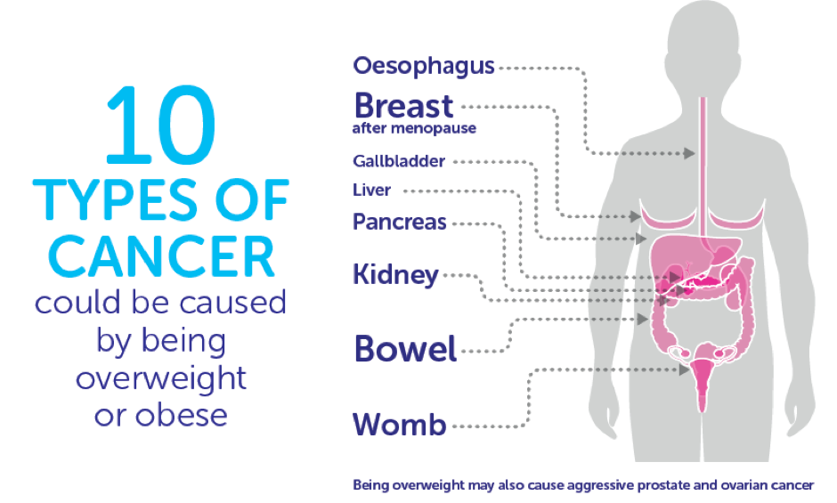 cruk-obesity-and-cancer-risk-top-10