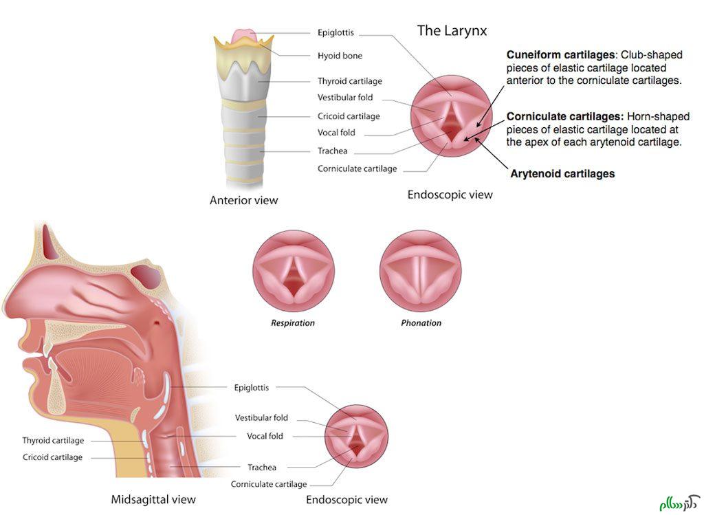 larynx-laryngomalacia