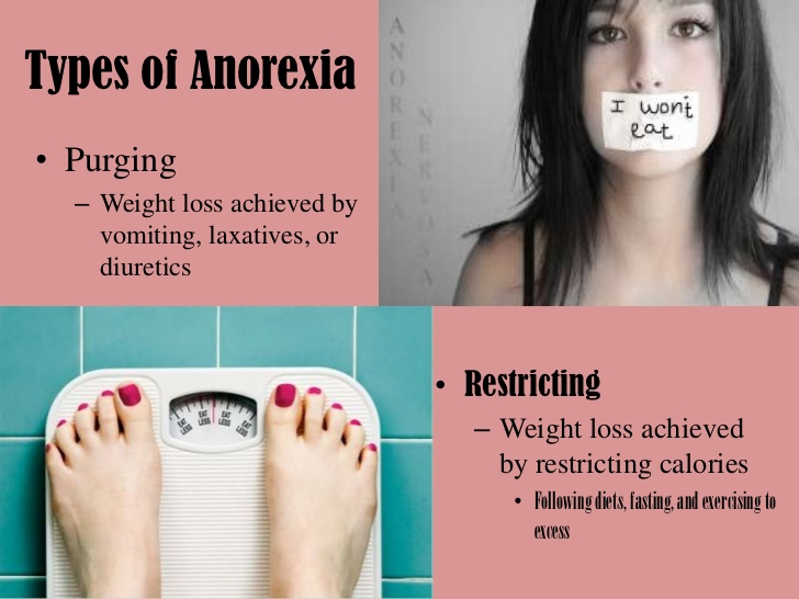 powerpoint-anorexia-3-728