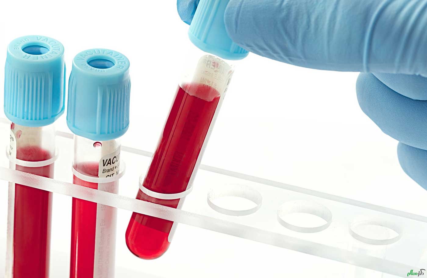 blood-type-test