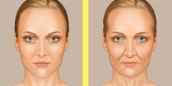 علائم تغییرات هورمونی در پوست روند تغییرات پوست تغییرات پوست در سنین مختلف علائم تغییرات هورمونی در پوست روند تغییرات پوست تغییرات پوست در سنین مختلف 