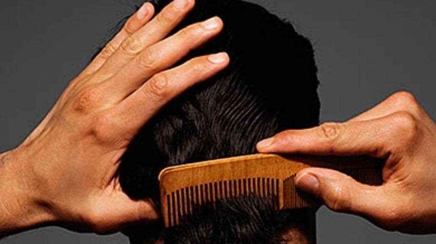 ریزش مو و طاس شدن راهکار موثر در درمان طاسی آلوپسی چیست PRP چیست 