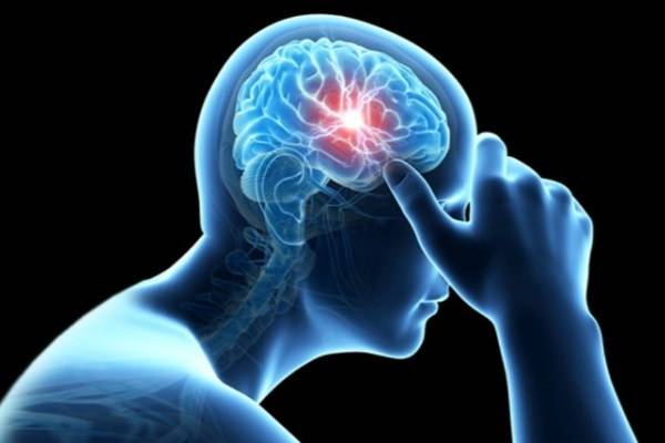 عوامل بروز سکته مغزی علت سکته مغزی سکته مغزی پیشگیری از سکته مغزی 