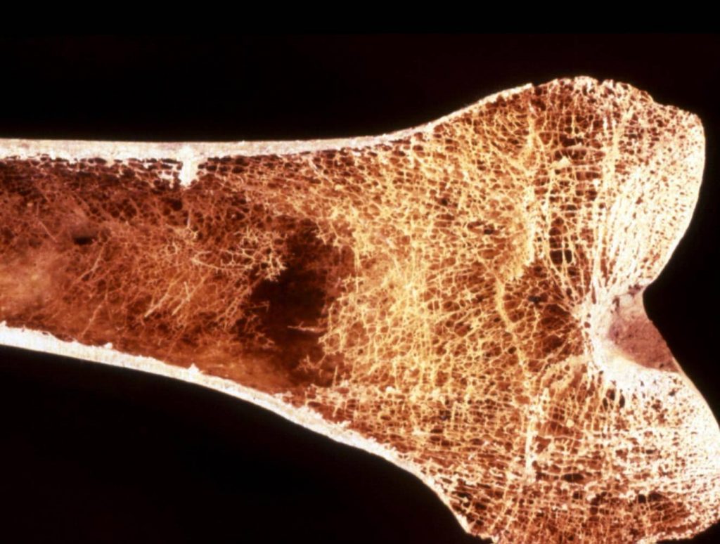 فناوری جدید برای مشاهده سلولهای استخوانی
