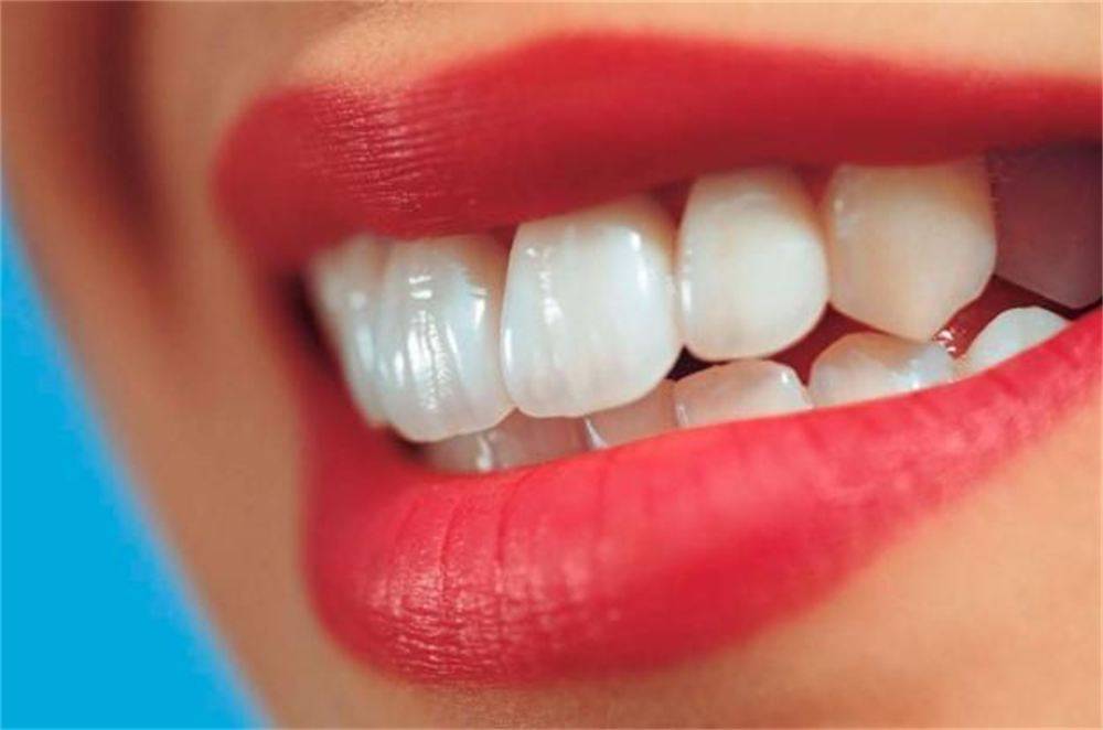 سفیدکننده خانگی سفید کردن دندان‌ چگونه دندانهایمان را سفید کنیم 