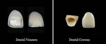 کامپوزیت چیست کاشت دندان فواید ایمپلنت روش ایمپلنت درمان لمينيت سراميكي پرسلن چيست کامپوزیت چیست کاشت دندان فواید ایمپلنت روش ایمپلنت درمان لمينيت سراميكي پرسلن چيست کامپوزیت چیست کاشت دندان فواید ایمپلنت روش ایمپلنت درمان لمينيت سراميكي پرسلن چيست کامپوزیت چیست کاشت دندان فواید ایمپلنت روش ایمپلنت درمان لمينيت سراميكي پرسلن چيست کامپوزیت چیست کاشت دندان فواید ایمپلنت روش ایمپلنت درمان لمينيت سراميكي پرسلن چيست کامپوزیت چیست کاشت دندان فواید ایمپلنت روش ایمپلنت درمان لمينيت سراميكي پرسلن چيست کامپوزیت چیست کاشت دندان فواید ایمپلنت روش ایمپلنت درمان لمينيت سراميكي پرسلن چيست 