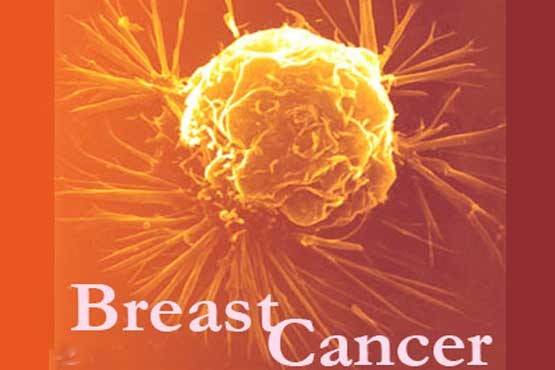 فررفتن نوک پستان سرطان پستان درباره سرطان پستان تغییر در شکل یا اندازه پستان پوست‌پرتقالی شدن پوست پستان 