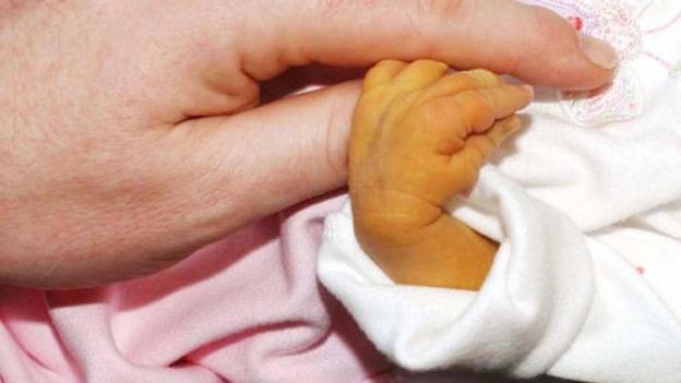 علت زردی در نوزادان درمان زردی در نوزادان تفاوت rh مادر و نوزاد 