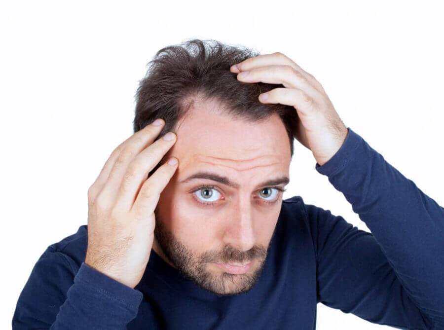 درمان های طبیعی برای ریزش موهای چرب