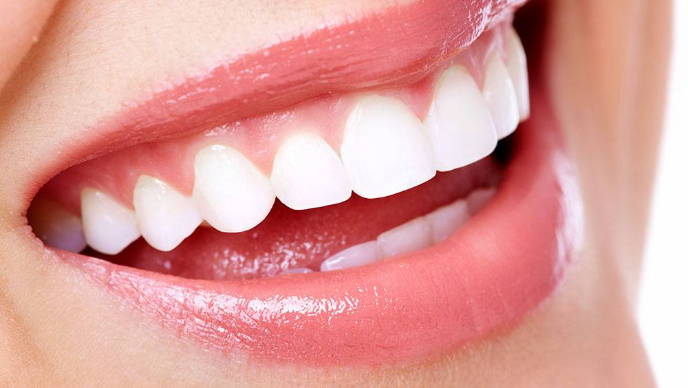 مزایای ایمپلنت کاشت دندان درمان های زیبایی دندان جراحی تمام فک پروتز متحرک ایمپلنت 