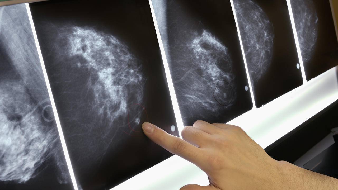روش های مهار سرطان سینه 