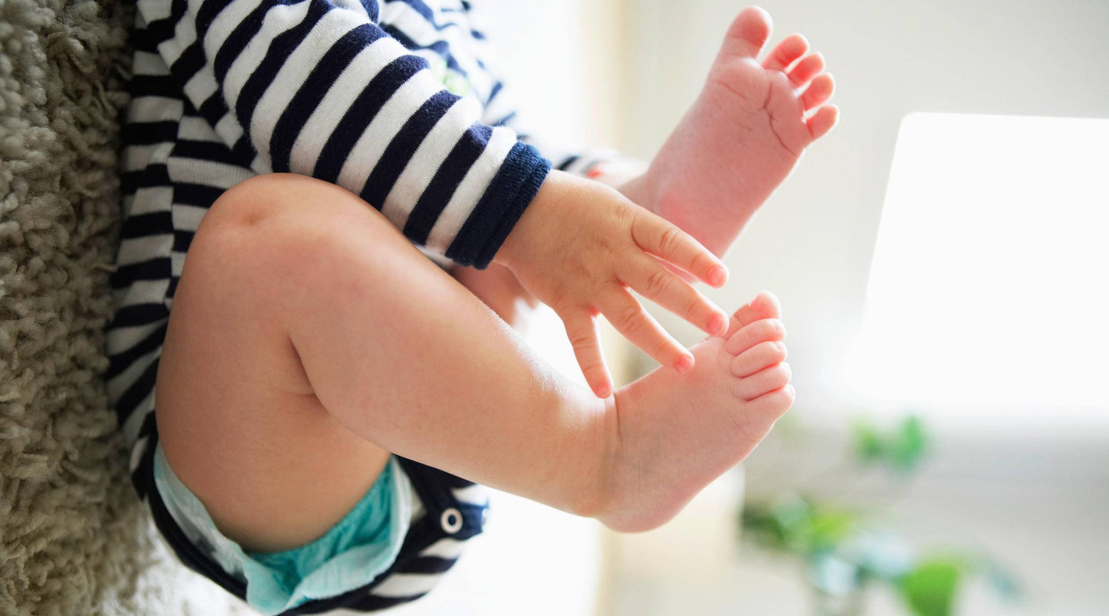 کج بودن زانو علائم پا ضربدری زانوی ضربدری روش های درمان پای ضربدری درمان زانوی ضربدری پای ضربدری در کودکان پا ضربدری 