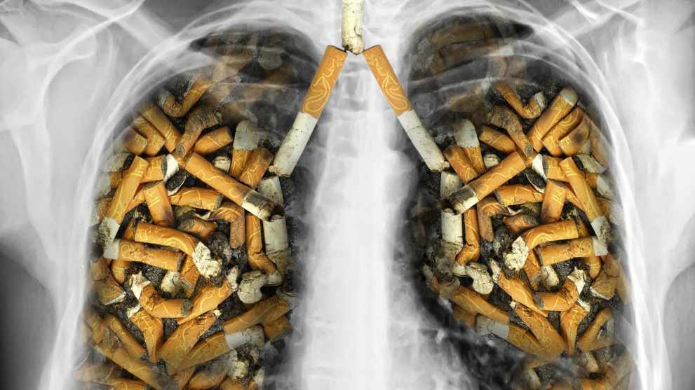تاثیر دخانیات در ابتلا به سرطان ریه