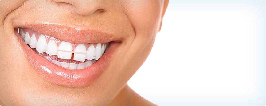 فاصله بین دندان ها دلایل و درمان