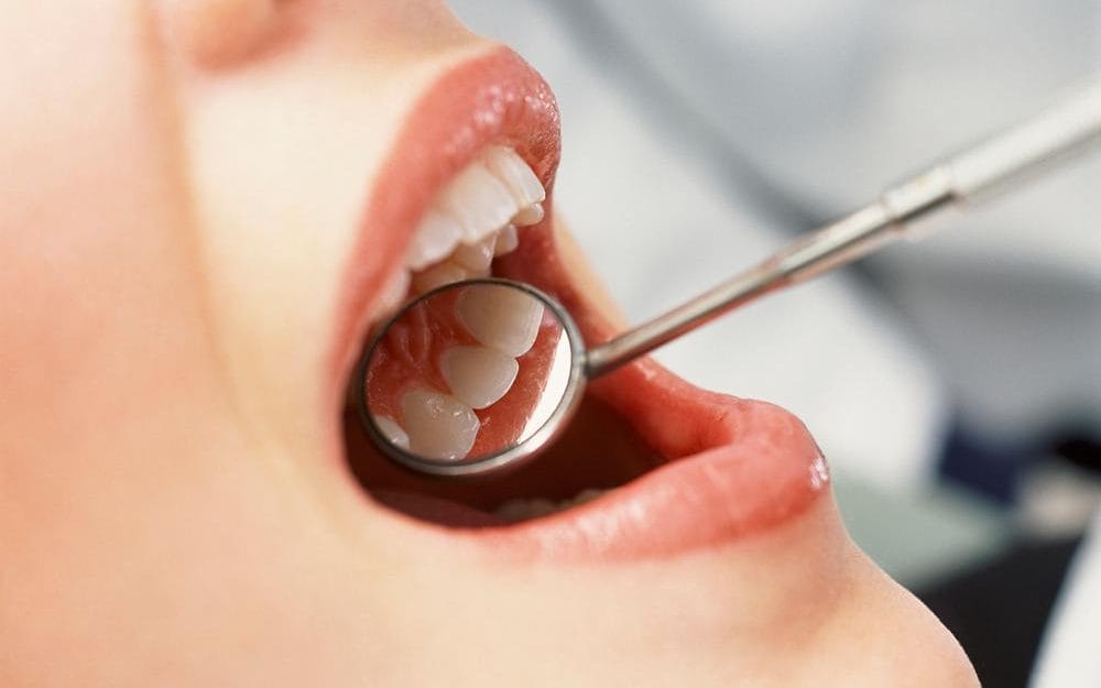 مراقبت از دندان های خردسالان در برابر پوسیدگی