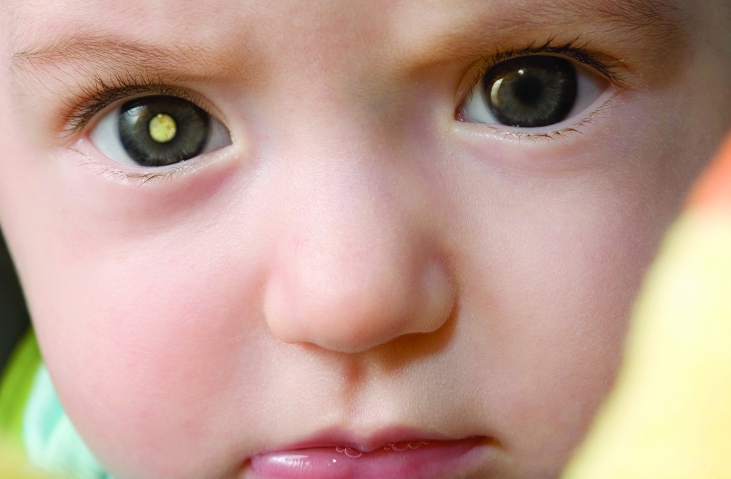 عوارض فلاش دوربین برای بینایی نوزادان
