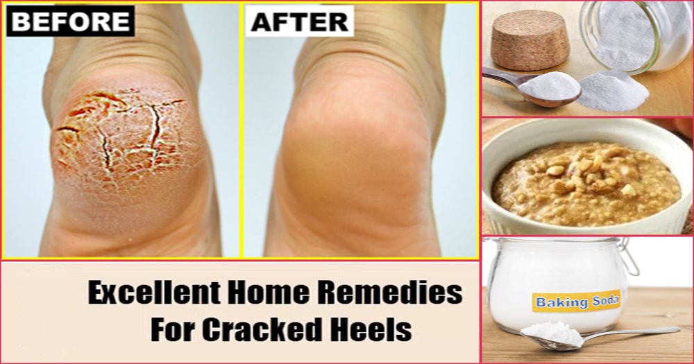 3 راهکار اصلی برای رفع خشکی پوست پا