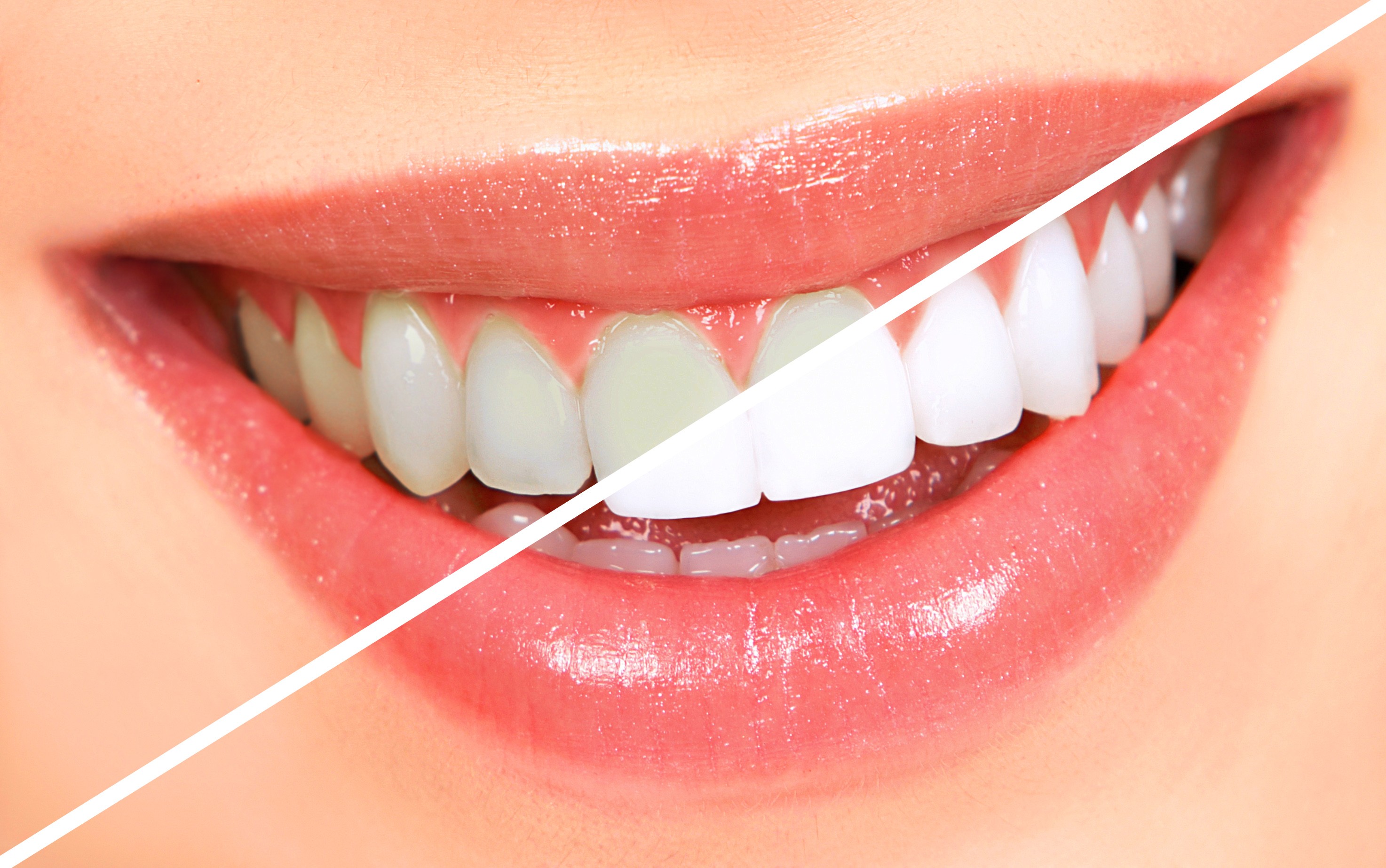روش های موثر برای سفید شدن دندان