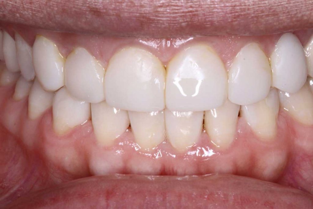 کامپوزیت دندانپزشکی نارمک
