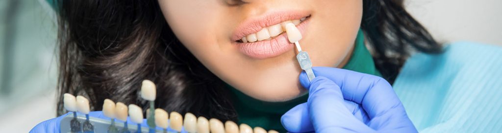 کامپوزیت دندانپزشکی نارمک