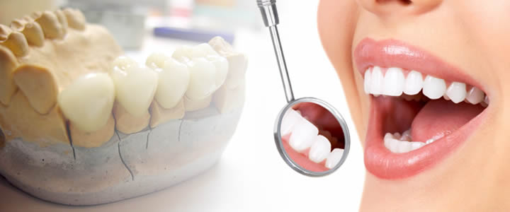 پروتز دندان دکتر منیره تهرانی