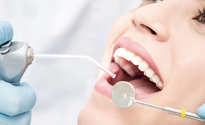 کامپوزیت دندان دندانپزشکی هیراد