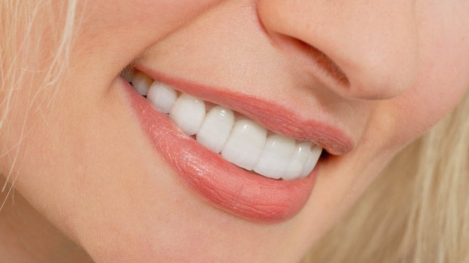 انواع ونیر کامپوزیت دندانپزشکی نارمک