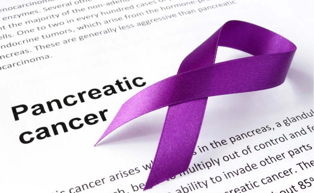 دانستنی های مهم در مورد سرطان پانکراس
