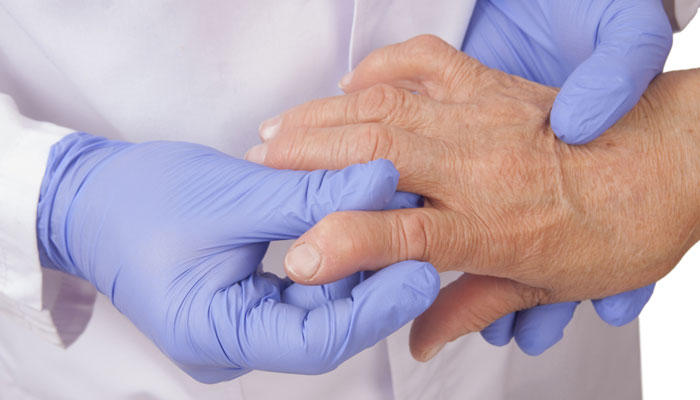 دست ها گنجینه ای از مهم ترین بیماری ها