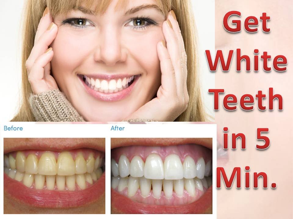 روش های طبیعی برای سفید شدن دندان