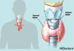 بیماری کم کاری تیروئید | علائم، درمان، رژیم غذایی
