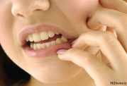 پوسیدگی دندان، شایع ترین بیماری جهان