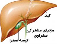 روزه گرفتن | بیماری کیسه صفرا و سنگ کلیه