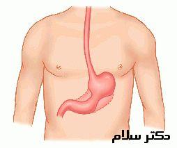 بیماری گوارشی | ریفلاکس، زخم معده، زخم اثنی عشر