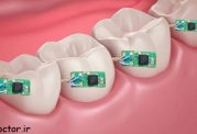 دندان مصنوعی بلوتوث دار تکنولوژی جدید